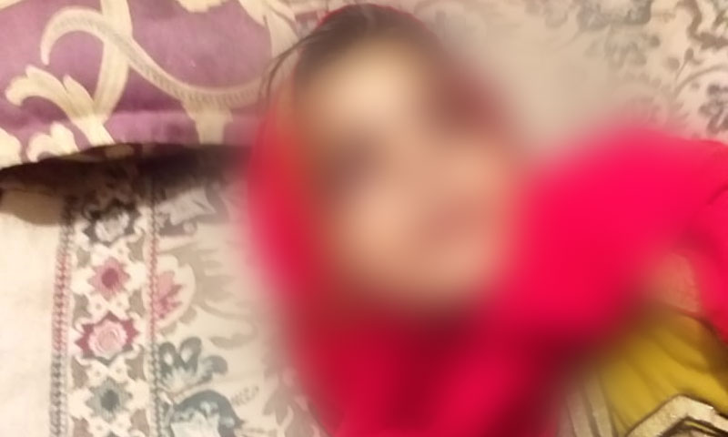 لاہور میں سوتیلی ماں کا بیٹی پر بدترین تشدد