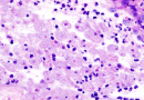 Naegleria