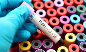 polio virus پولیو وائرس