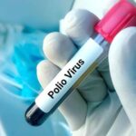 پولیو وائرس polio virus
