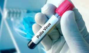 پولیو وائرس polio virus