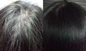 black and white hair
