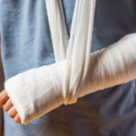Fracture