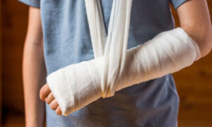 Fracture