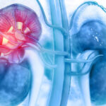 گردوں کے امراض دنیا کی ٹاپ 10 جان لیوا بیماریوں میں شامل، ابتدائی علامات جانیں