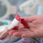 خاتون میں ٹیومر کی تشخیص، آپریشن کے دوران بچے کی پیدائش