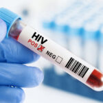 ایچ آئی وی کے مریضوں کی تعداد میں خطرناک اضافہ