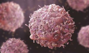 کینسر کے خطرے کو کم کرنے والی اہم غذائیں، ماہرین صحت کی رپورٹ