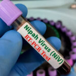 پاکستان میں نیپا وائرس کے ممکنہ پھیلاؤ کا خدشہ، الرٹ جاری