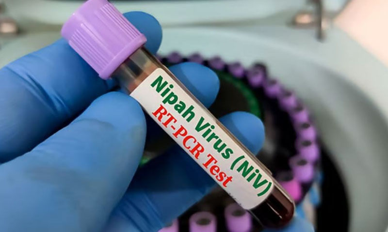 پاکستان میں نیپا وائرس کے ممکنہ پھیلاؤ کا خدشہ، الرٹ جاری
