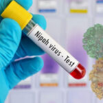 جان لیوا نیپا وائرس کیا ہے؟ علامات، علاج اور حفاظتی اقدامات