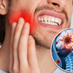 مسوڑھوں کا انفیکشن دماغی مرض کی شدت بڑھا سکتا ہے: نئی تحقیق