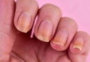 ناخنوں کے رنگ میں تبدیلی، مختلف بیماریوں کی علامات: ماہرین کی وارننگ