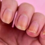 ناخنوں کے رنگ میں تبدیلی، مختلف بیماریوں کی علامات: ماہرین کی وارننگ